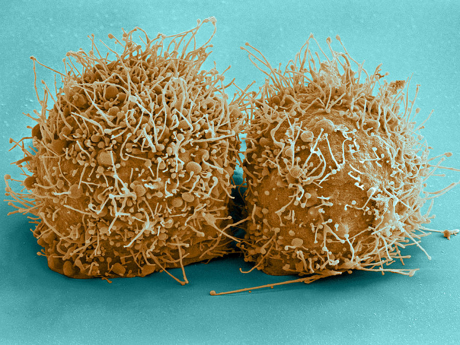 Dividing Hela Cells, Sem #3 Photograph by Science Source