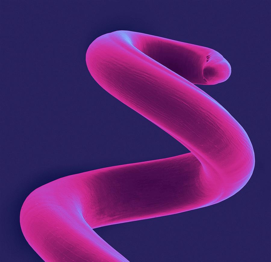 Dog Lungworm Photograph by Dennis Kunkel Microscopy/science Photo Library - Fine Art America