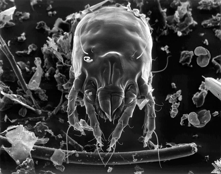 Dust Mite #3 Photograph by Dennis Kunkel Microscopy/science Photo Library