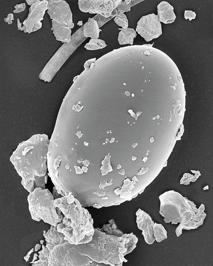 Dust Mite Egg (dermatophagoides Sp.) Photograph by Dennis Kunkel