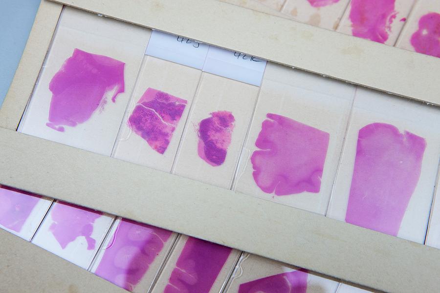 Dyed Brain And Tissue Specimens #3 Photograph by Lewis Houghton/science Photo Library