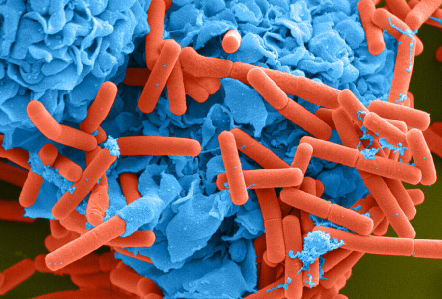 E. Coli And Macrophage Sem #3 Photograph by Science Source