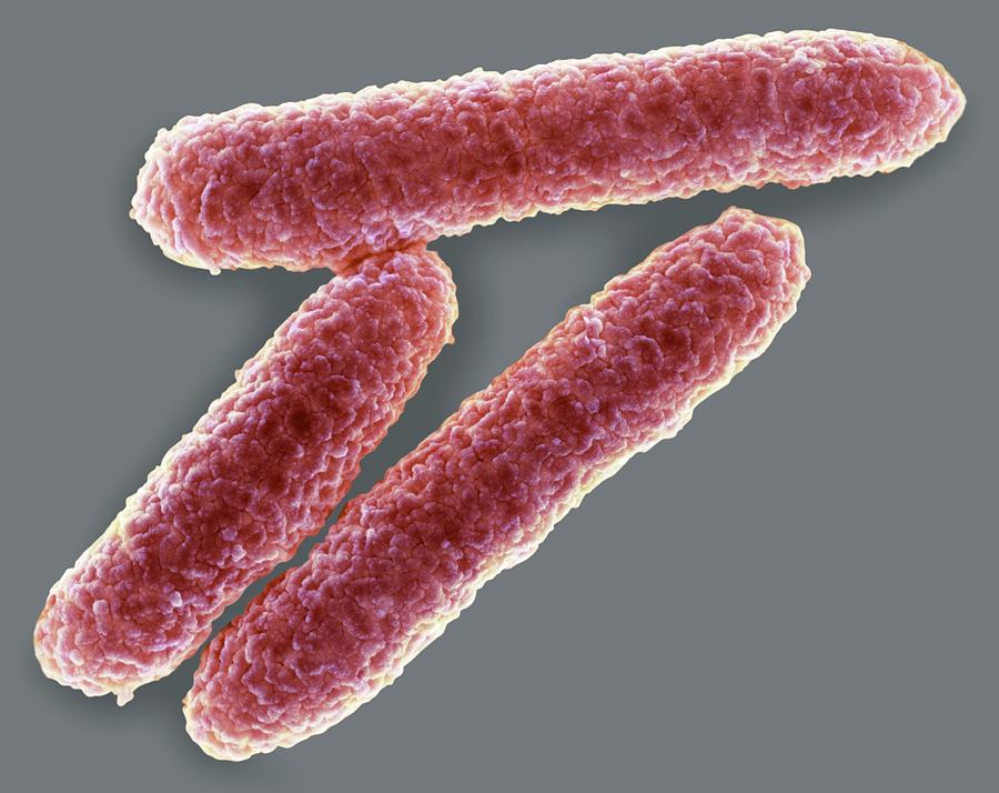 Escherichia Coli Photograph - E. Coli Bacteria #3 by Science Photo Library