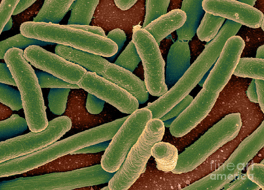Escherichia Coli Bacteria, Sem #3 Photograph by Science Source