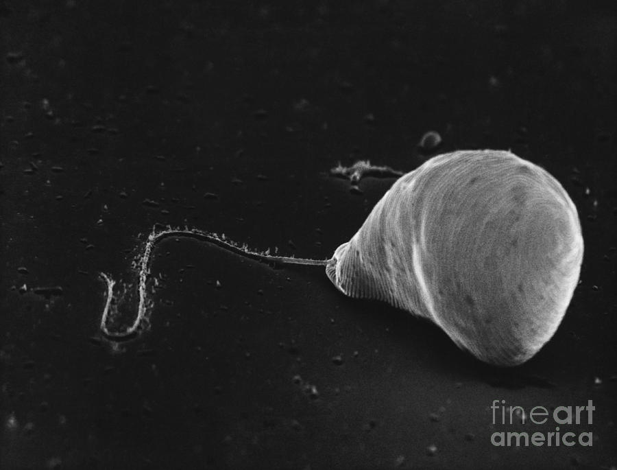 Black And White Photograph - Euglena Sem #3 by David M. Phillips
