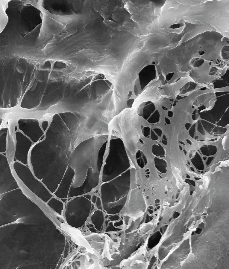 Extracellular Matrix #3 Photograph by Dennis Kunkel Microscopy/science Photo Library