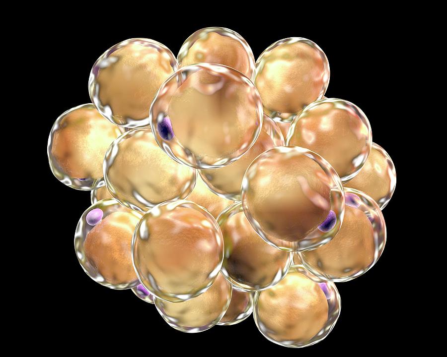 fat-cells-photograph-by-kateryna-kon-science-photo-library