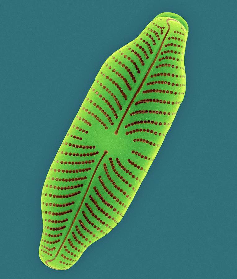 Fresh Water Pennate Diatom (navicula Sp.) #3 Photograph by Dennis Kunkel Microscopy/science Photo Library