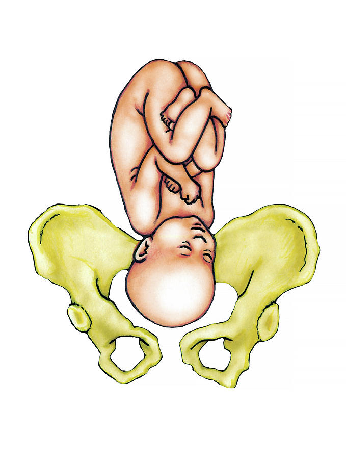 Full Term Foetus Photograph By Asklepios Medical Atlas Fine Art America 6706