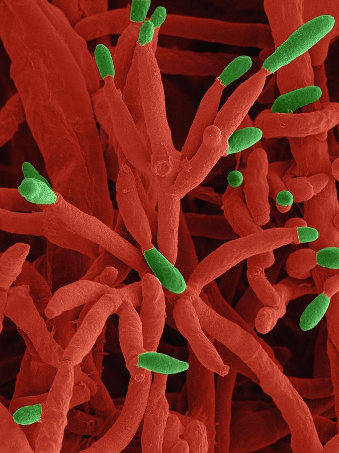 Fusarium Incarnatum Pathogenic Fungus #3 Photograph by Dennis Kunkel Microscopy/science Photo Library