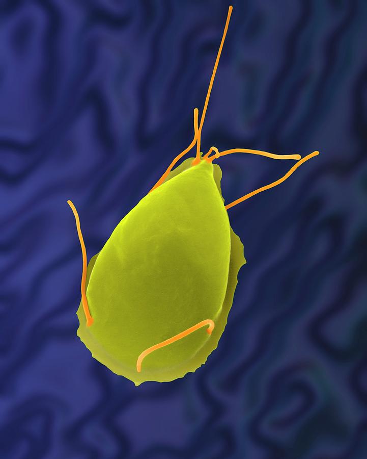 Animal Photograph - Giardia Lamblia Parasitic Protozoan #3 by Dennis Kunkel Microscopy/science Photo Library
