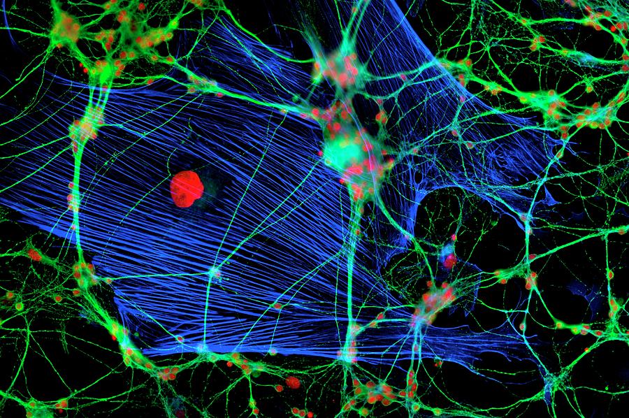 Glial Cells #3 Photograph by Dr Jan Schmoranzer/science Photo Library