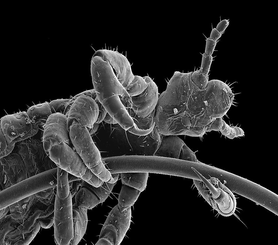 head-louse-photograph-by-steve-gschmeissner-science-photo-library-pixels