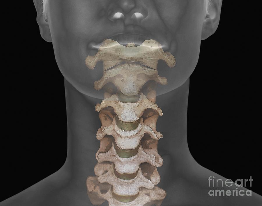 Bone Photograph - Healthy Spine, Ct Scan #3 by Zephyr