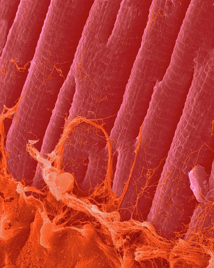 Heart Muscle Fibres  #3 Photograph by Dennis Kunkel Microscopy/science Photo Library