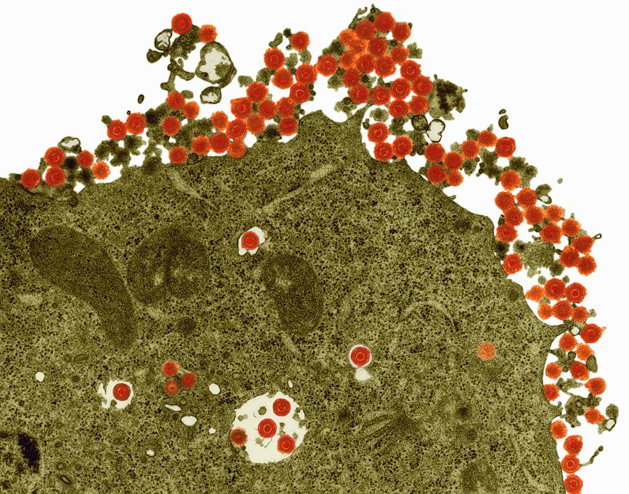 Herpes Simplex Virus #3 Photograph by Dennis Kunkel Microscopy/science Photo Library