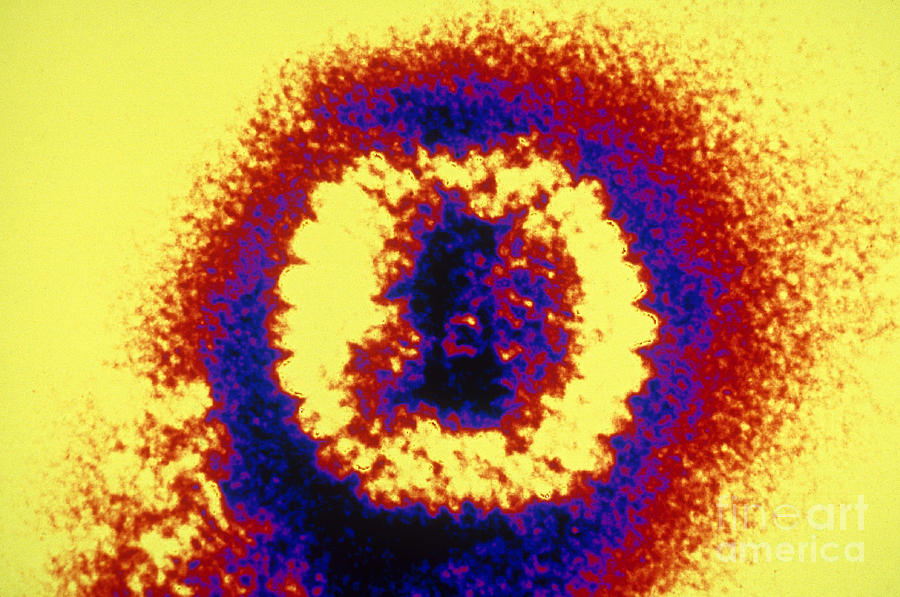Histology Photograph - Herpes Simplex Virus Tem #3 by Scott Camazine