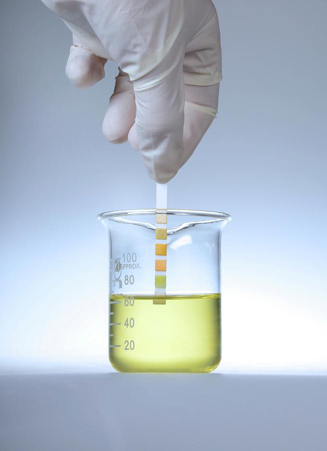 Adult Photograph - Home Urine Test #3 by Cordelia Molloy