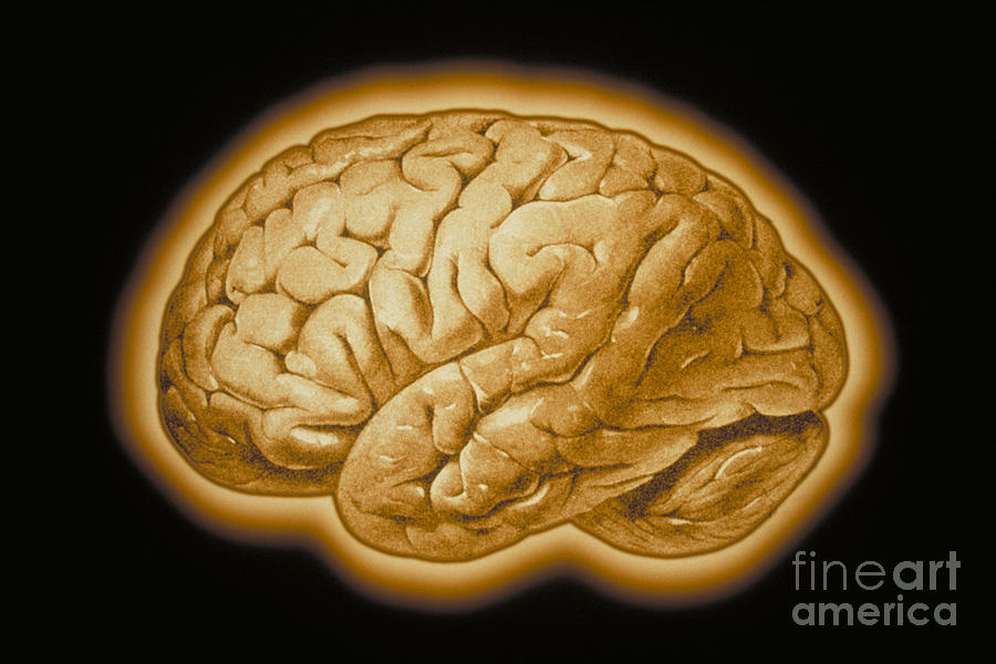 Human Brain #3 Photograph by Scott Camazine