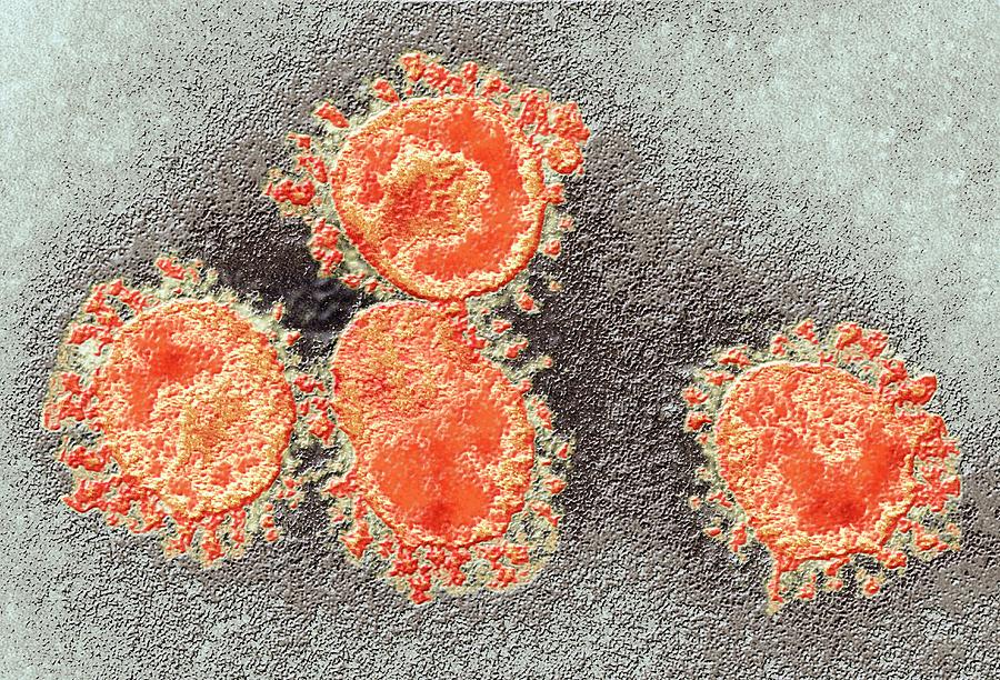 Coronavirus Photograph - Human Coronavirus #3 by Ami Images/science Photo Library