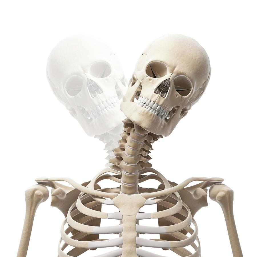 Неправильный скелет шеи