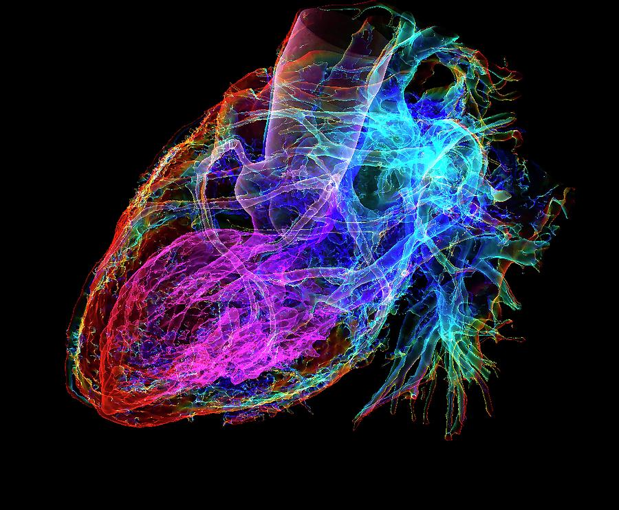 Human Heart Photograph by K H Fung/science Photo Library