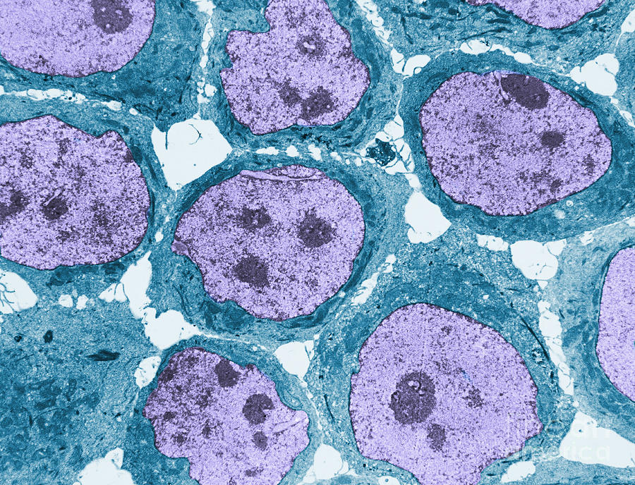 Human Kb Cells Tem #3 Photograph by David M. Phillips