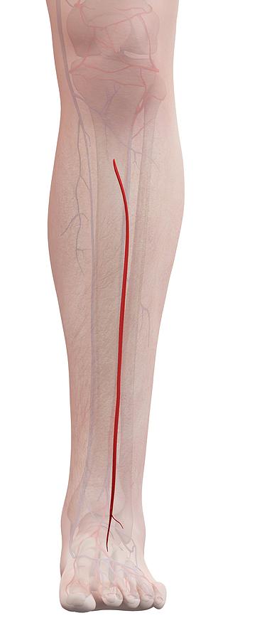 Human Leg Artery Photograph By Sciepro Fine Art America 6297