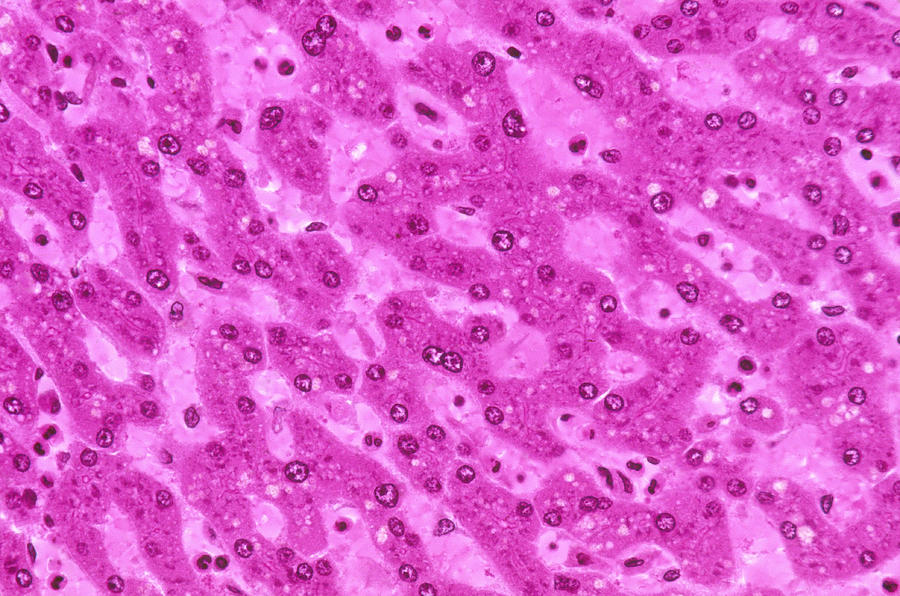 Human Liver, Lm #3 Photograph by Michael Abbey