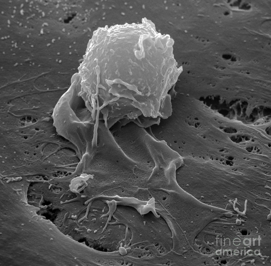 Human Macrophage #3 Photograph by David M. Phillips