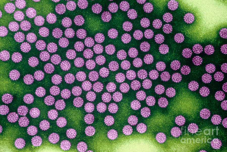 Human Papillomavirus #3 Photograph by Kwangshin Kim