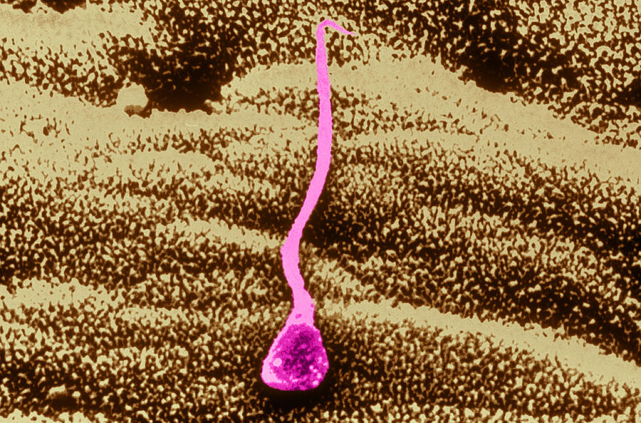Human Sperm In Uterus #3 Photograph by John Watney
