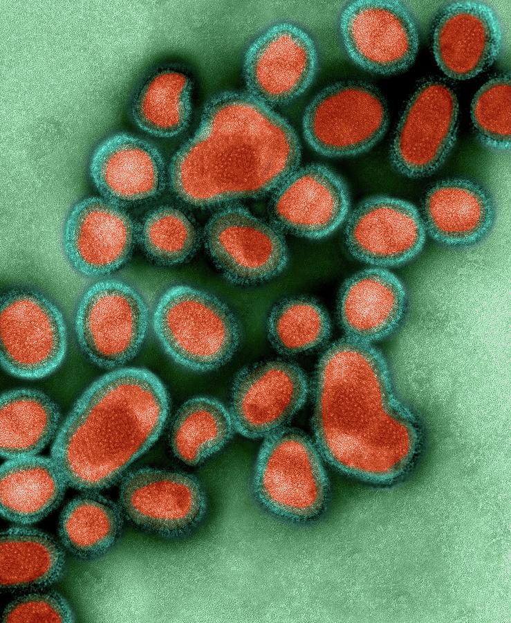 Human Swine Flu Virus H1n1 #3 Photograph by Dennis Kunkel Microscopy/science Photo Library