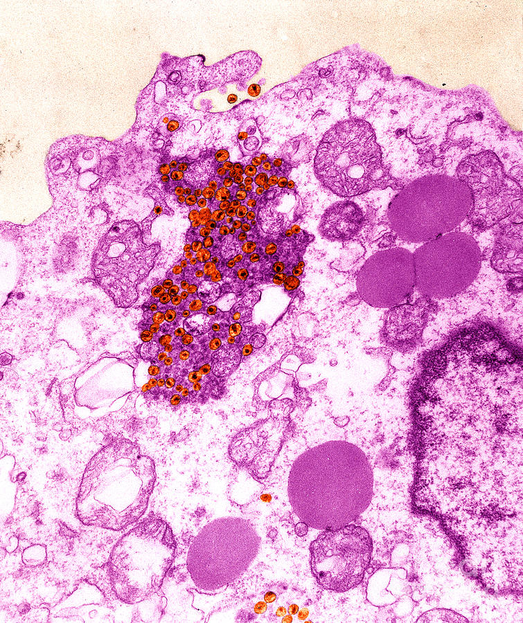 Tem Photograph - Human T-lymphocyte Showing Hiv #3 by Kwangshin Kim