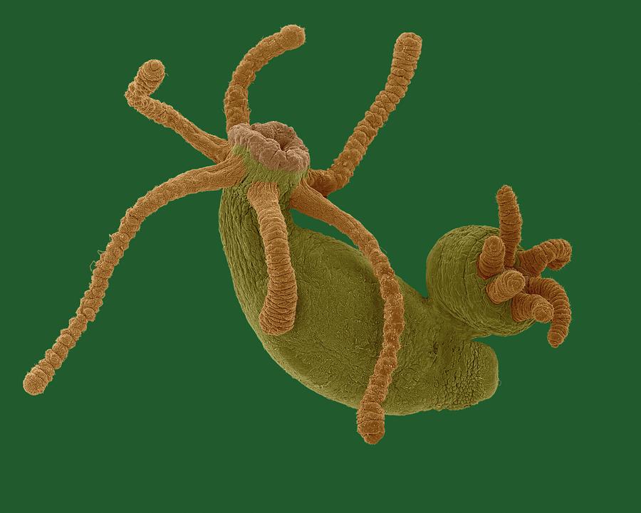 Hydra Sp. Budding (cnidarian) #3 Photograph by Dennis Kunkel Microscopy/science Photo Library