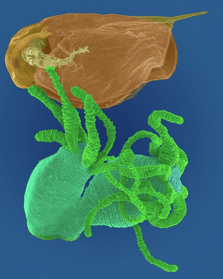 Hydra Sp. Capturing Daphnia Sp. #3 Photograph by Dennis Kunkel Microscopy/science Photo Library