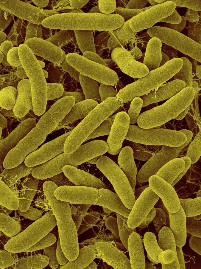 Janibacter Hoylei Photograph By Dennis Kunkel Microscopyscience Photo Library 