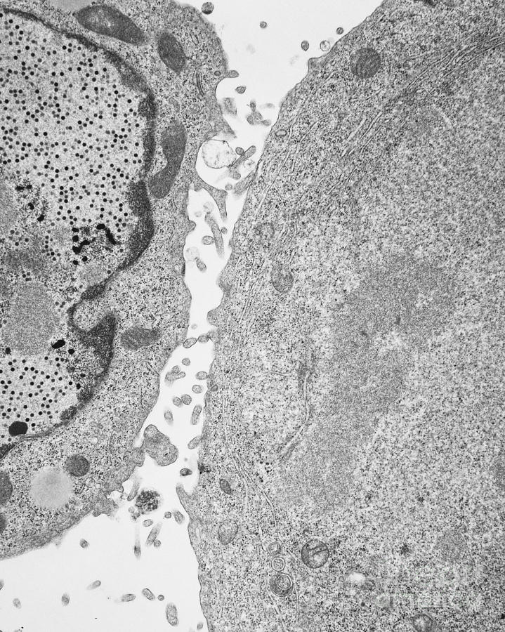 Kb Cell Infected With Adenovirus Tem #3 Photograph by David M. Phillips