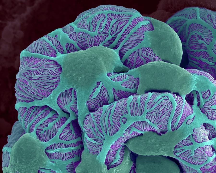 Kidney Glomerulus Photograph by Dennis Kunkel Microscopy/science Photo Library
