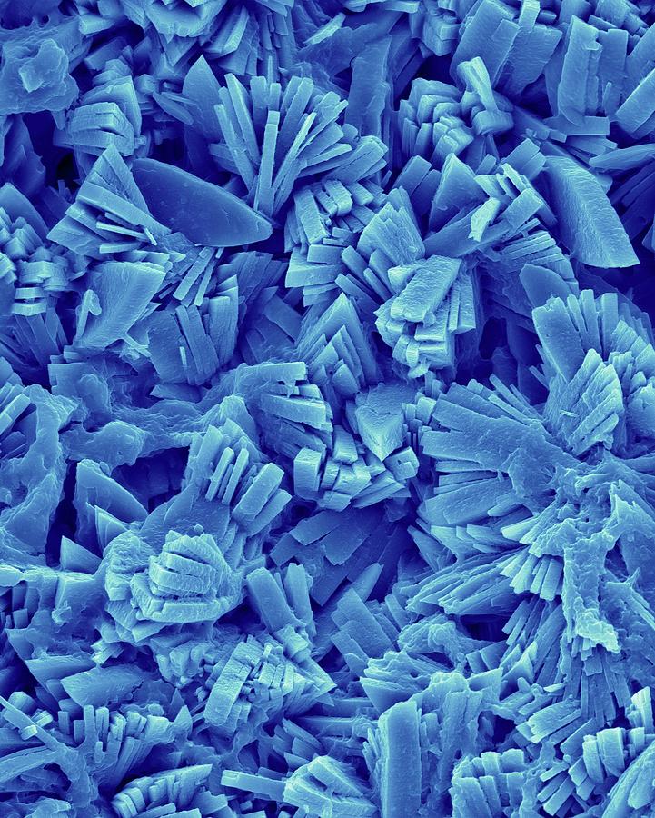 Kidney Stone Monoclinic Crystals Photograph by Dennis Kunkel Microscopy/science Photo Library