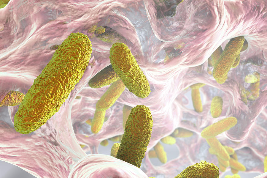 Klebsiella Pneumoniae Bacteria #3 Photograph by Kateryna Kon/science Photo Library