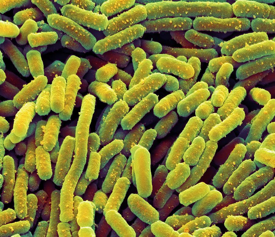 lactobacillus bacteria