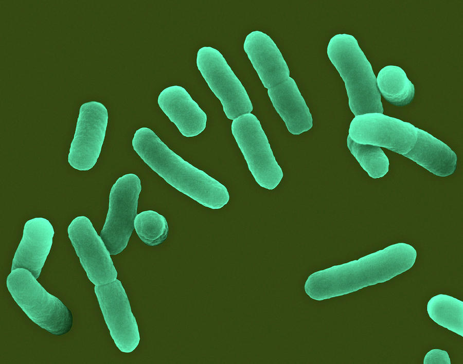 Lactobacillus Sp.- Rod Prokaryote #3 by Dennis Kunkel Microscopy ...