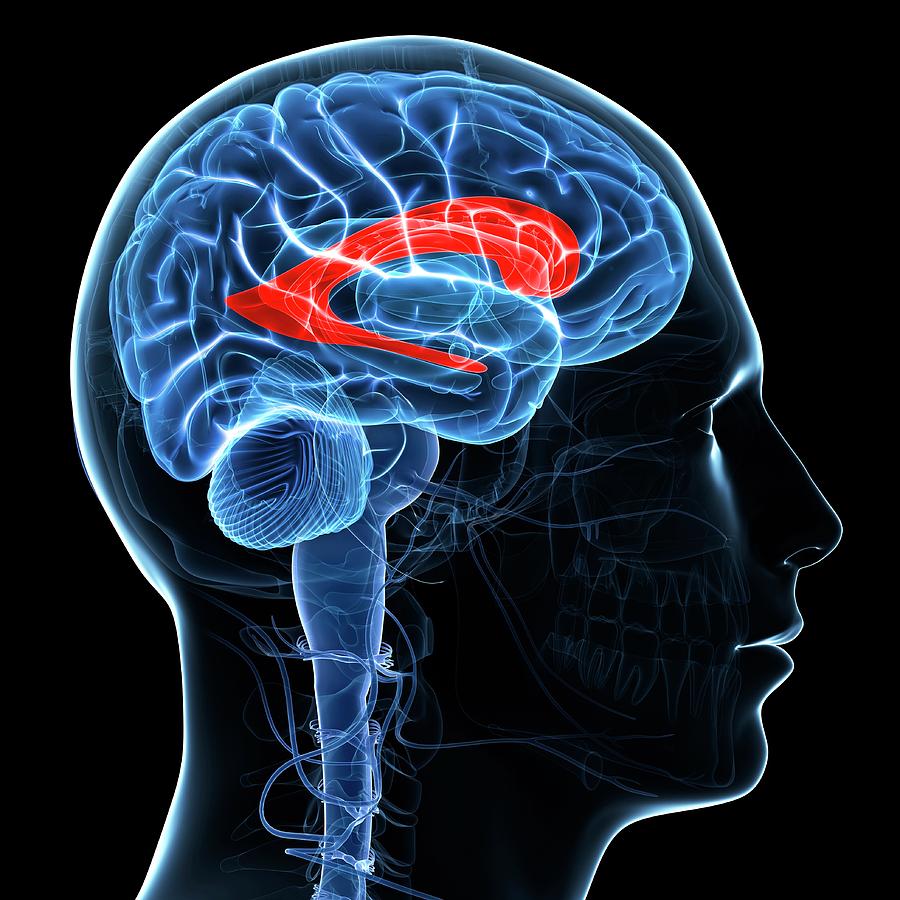 Lateral Ventricle Photograph by Sciepro/science Photo Library - Fine ...