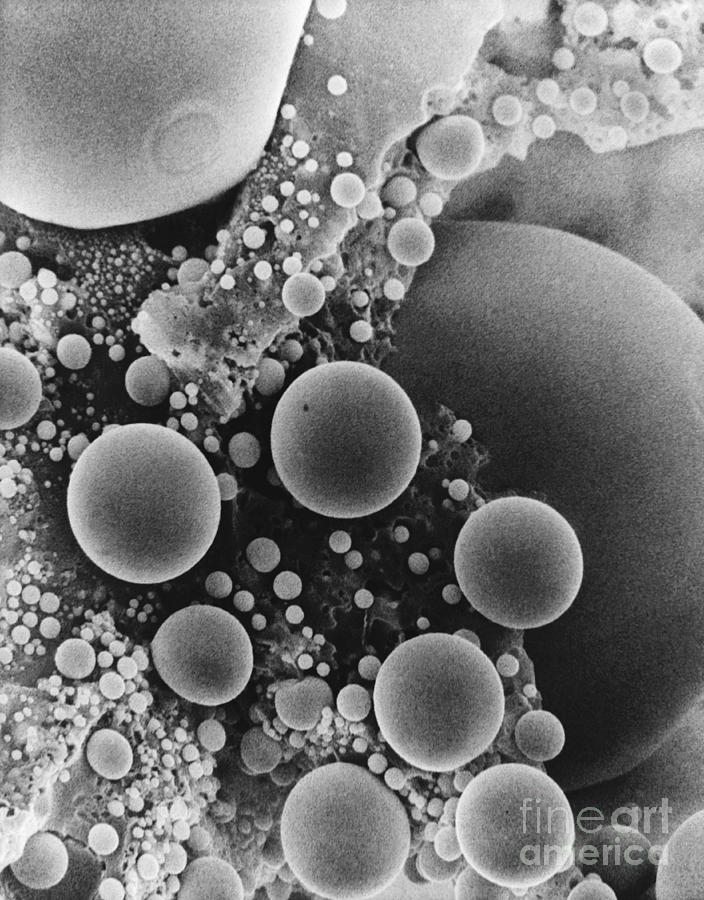 Lipid Droplets Sem #3 Photograph by David M. Phillips