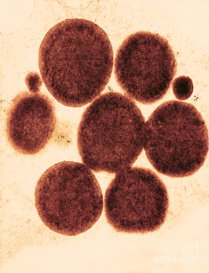 Lipid Droplets Tem #3 Photograph by David M. Phillips