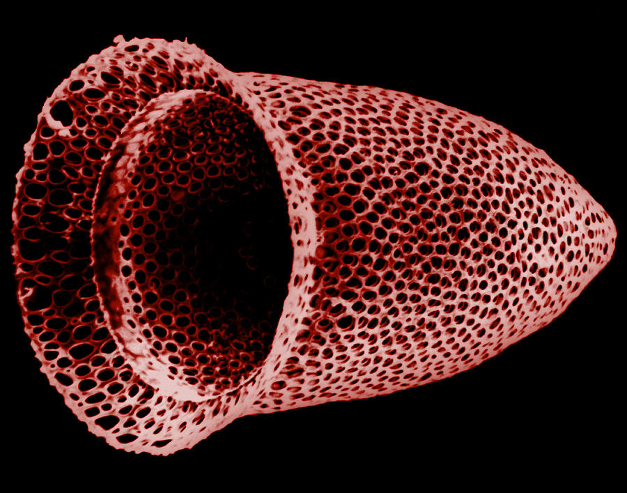 Lorica Shell Of Tintinnid Ciliate Sem #3 Photograph by Greg Antipa