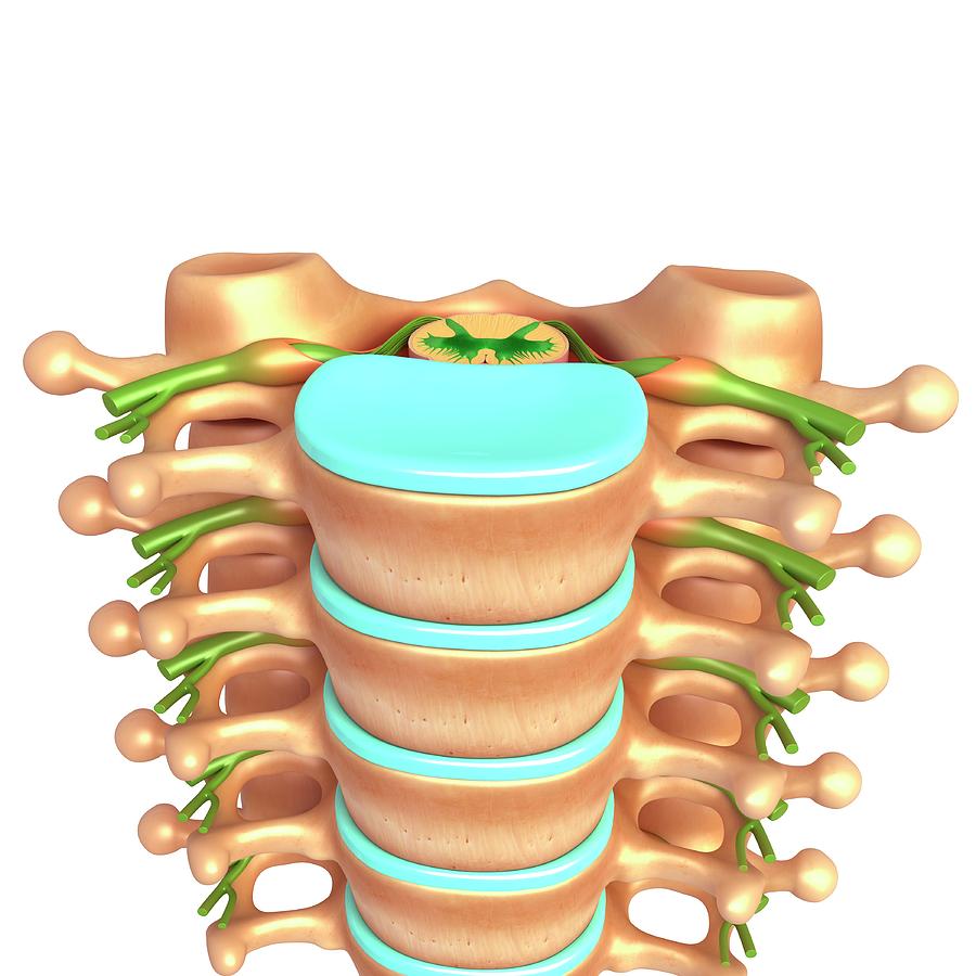 Lumbar Vertebrae Photograph by Pixologicstudio/science Photo Library ...