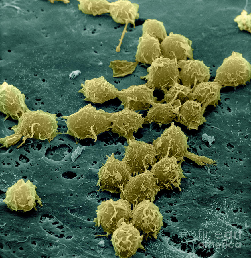 Macrophages On The Surface #3 Photograph by David M. Phillips