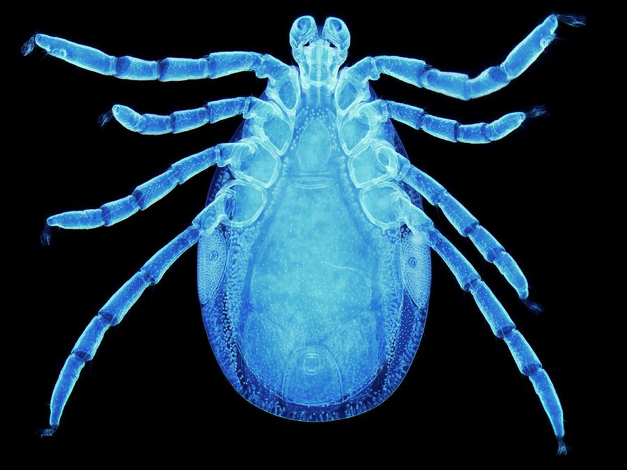 Male Lyme Disease Tick #3 Photograph by Steve Gschmeissner/science Photo Library